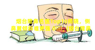 烟台隆鼻名医Top10揭晓，侧鼻翼倾斜谁更强 🌸 (烟台隆鼻名医top10揭晓,侧鼻翼倾斜谁更强)